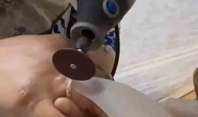 Kazada yaralanan kadının parmağına sıkışan yüzüğü itfaiye ekipleri çıkardı