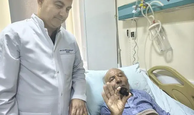 Bozyazı'da 4 santimetrelik mesane taşı tek parça halinde çıkarıldı.